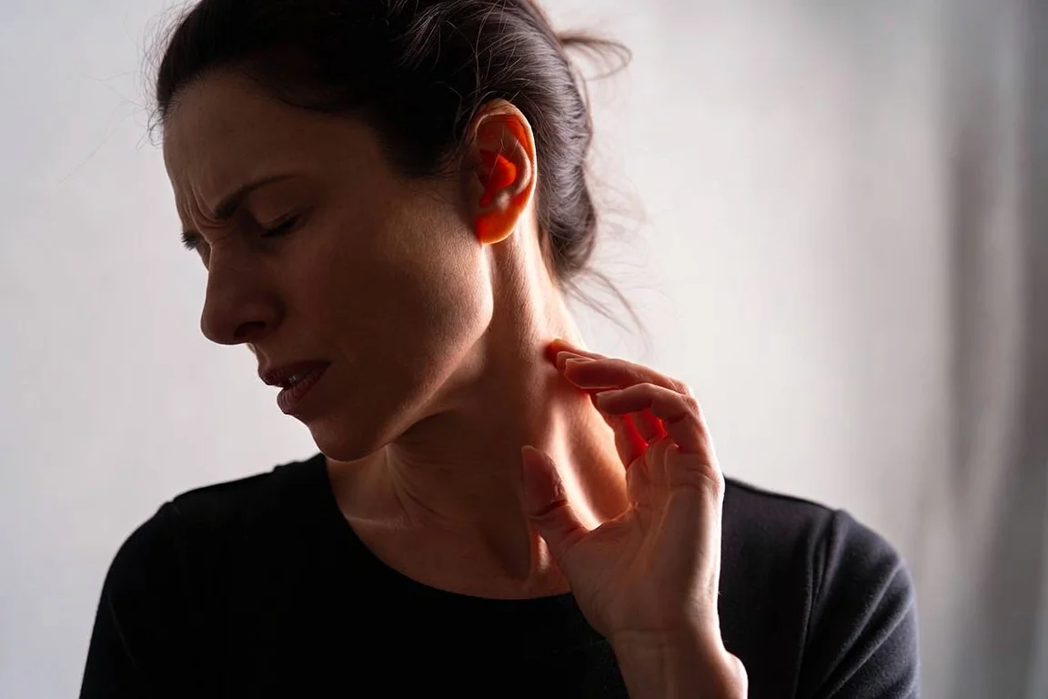 mujer con dolor lateral del cuello esternocleidomastoideo